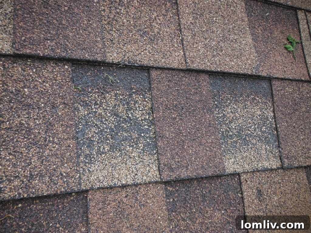 shingles