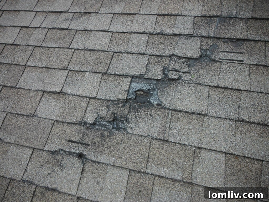 shingles